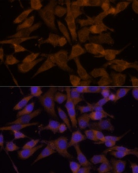 UGT2B7 Antibody