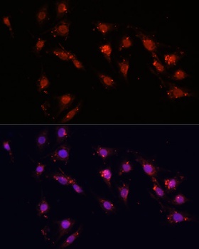 Ki67 Antibody