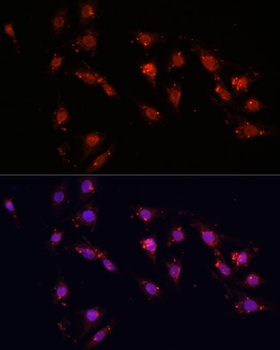 MKI67 Antibody