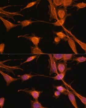 SMAD2 Antibody