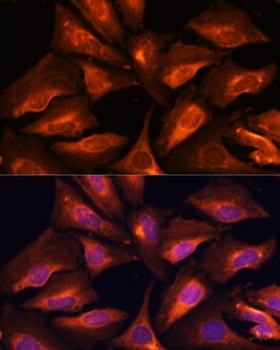 SMAD2 Antibody