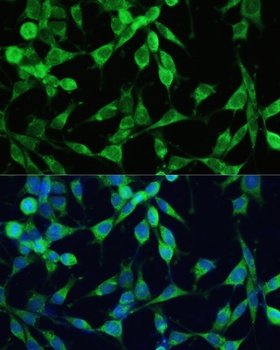 SMAD2 Antibody