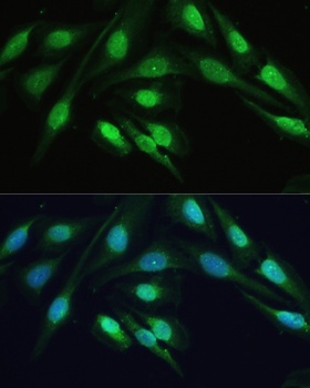 SMAD2 Antibody