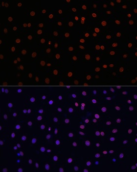 SMAD2 Antibody