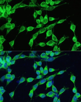 SMAD2 Antibody