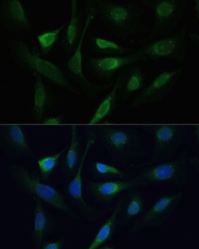 SMAD2 Antibody