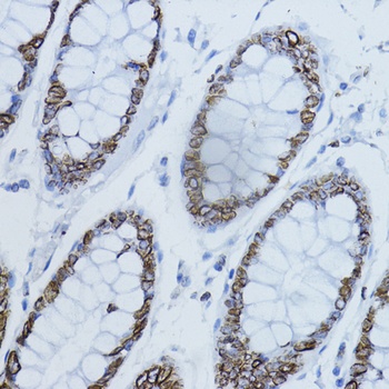 LMNB1 Antibody