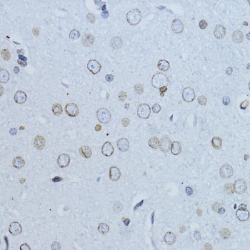 LMNB1 Antibody