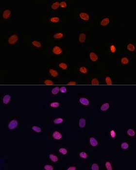 LMNB1 Antibody