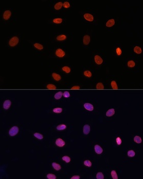 LMNB1 Antibody