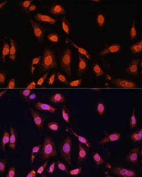Lamin B1 Antibody