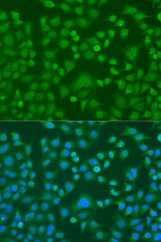 EWSR1 Antibody