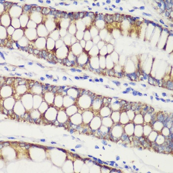 TOM20 Antibody