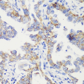 TOM20 Antibody