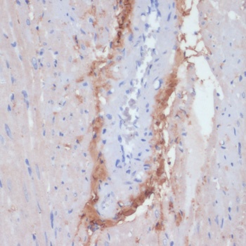 TOM20 Antibody