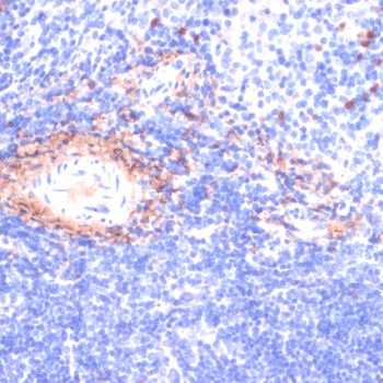 COL1A1 Antibody