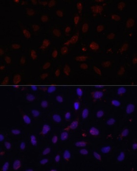 COL1A1 Antibody