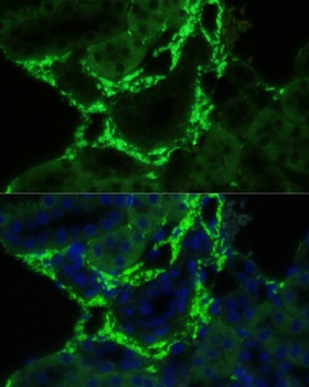 COL1A1 Antibody