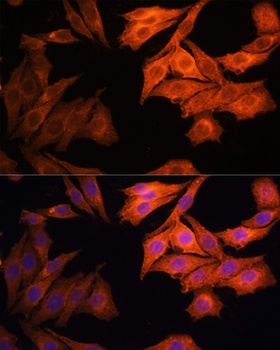 EGFR Antibody
