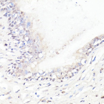 DMP1 Antibody