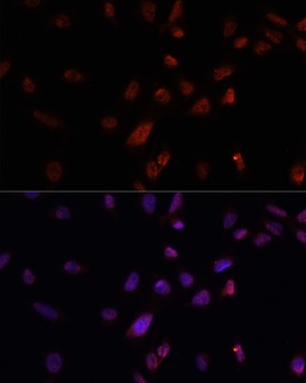 DMP1 Antibody