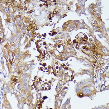 CD52 Antibody
