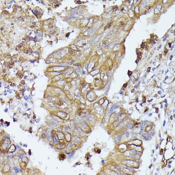 CD52 Antibody