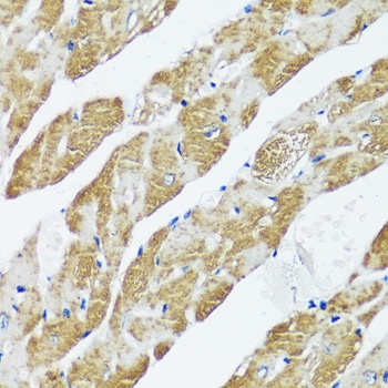 CASQ2 Antibody