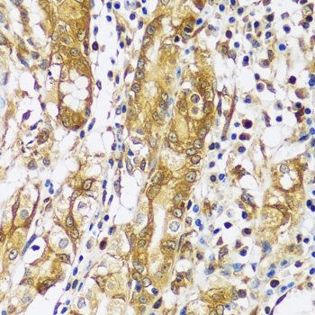 CAST Antibody