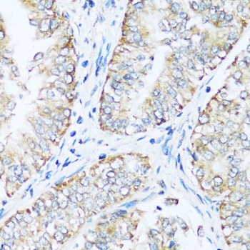 ATP5I Antibody