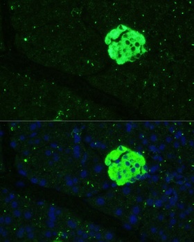 SFRP5 Antibody