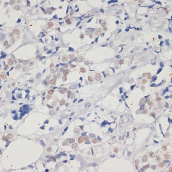 DNMT1 Antibody