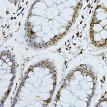 p27 KIP 1 Antibody