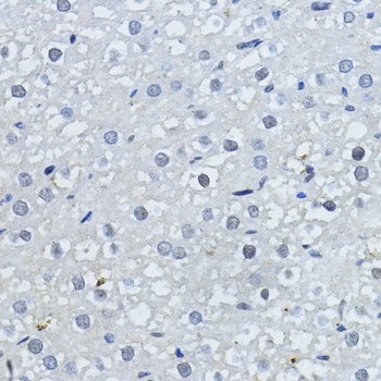 p27 KIP 1 Antibody