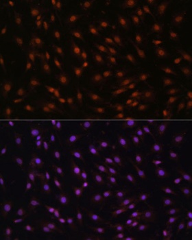 p27 KIP 1 Antibody