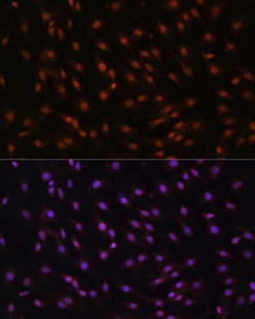 CDKN1B Antibody