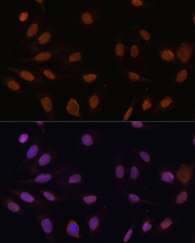p27 KIP 1 Antibody