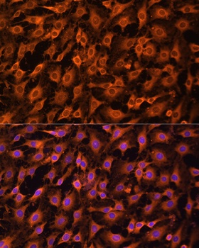 ERK1 / ERK2 Antibody