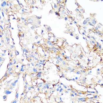 FN1 Antibody