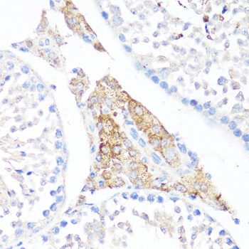 FN1 Antibody