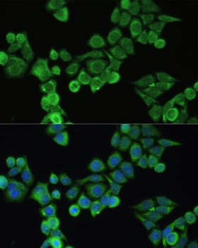 FN1 Antibody