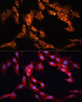 NOTCH1 Antibody