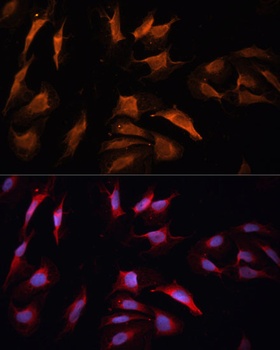 NOTCH1 Antibody