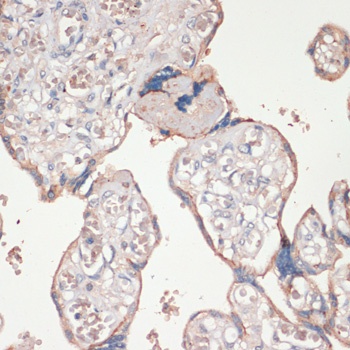ASC / TMS1 Antibody