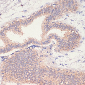 PRKAA1 Antibody