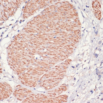 PRKAA1 Antibody