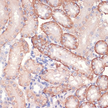 PRKAA1 Antibody