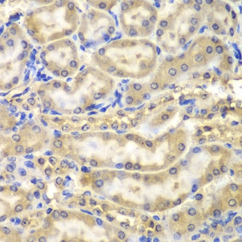 Myelin Basic protein Antibody