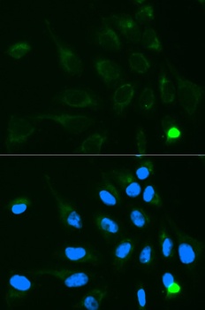 UGT1A9 Antibody