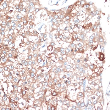 SLAMF7 Antibody